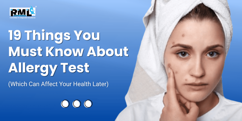 Allergy test in Lucknow