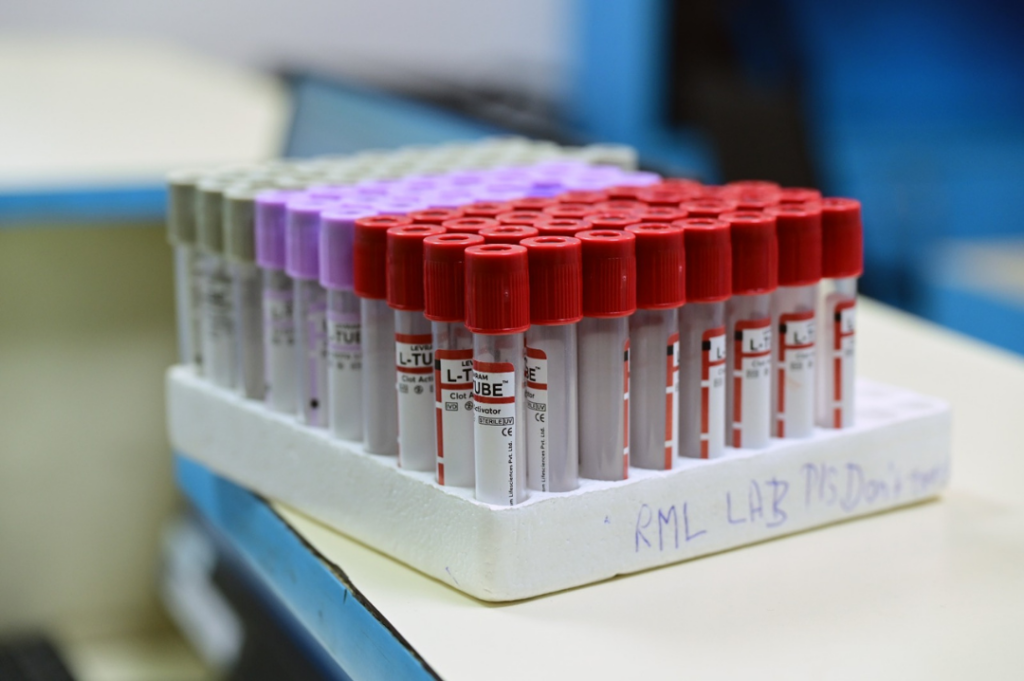 Best Pathology lab in Rajaji Puram
